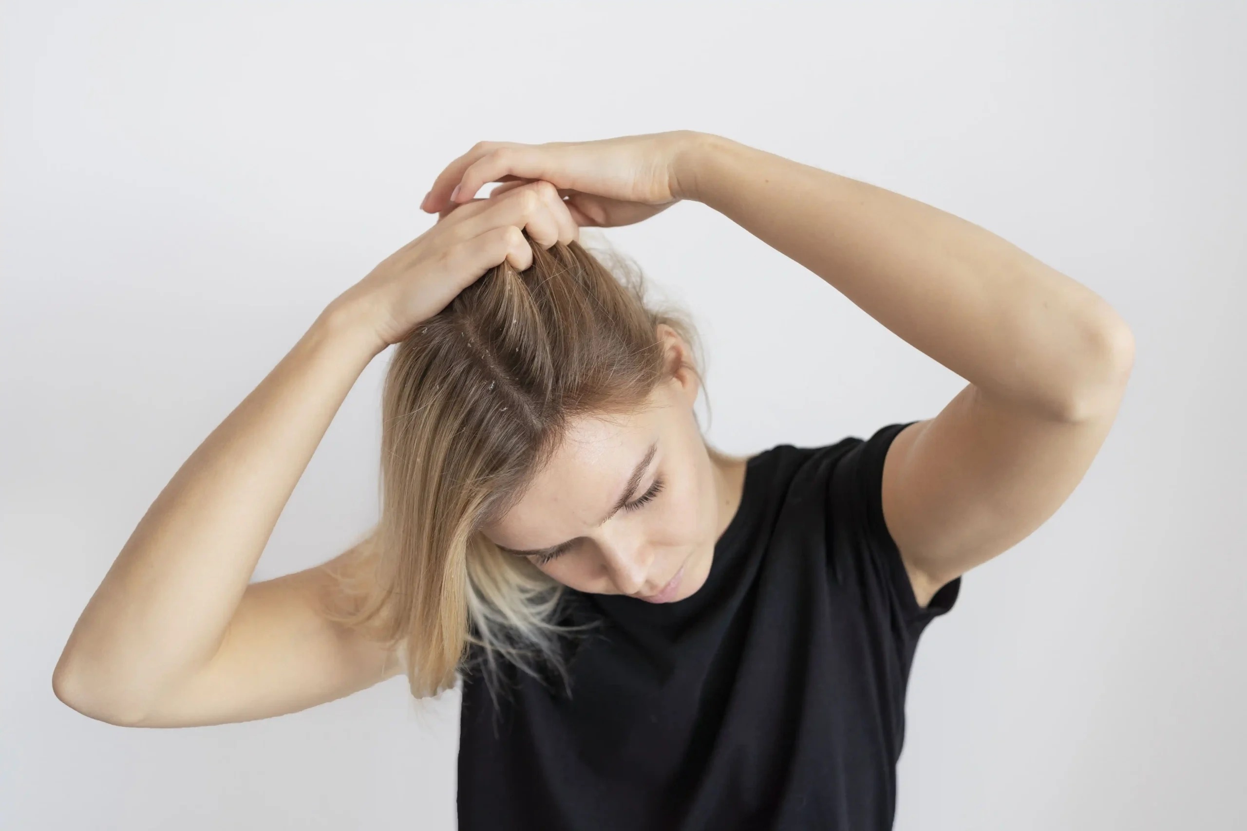 A woman checking her scalp and blonde hair for dandruff against a clean white background.