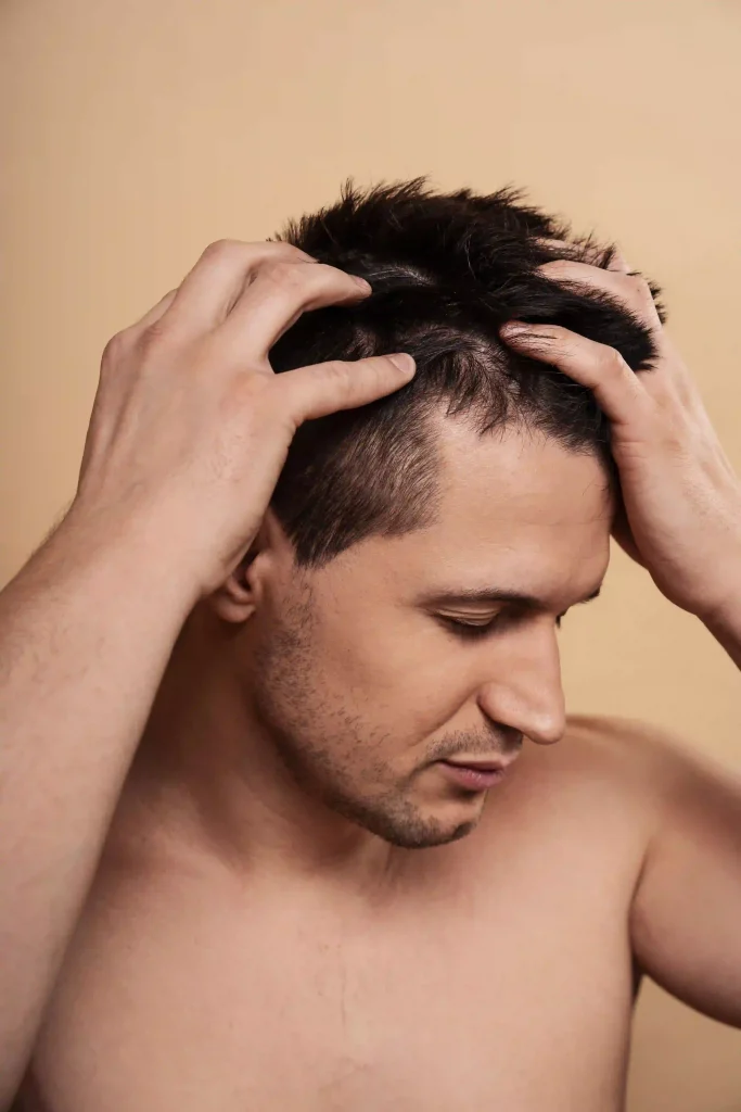 A man looking down while running his hands through his hair to check scalp health and hair density.